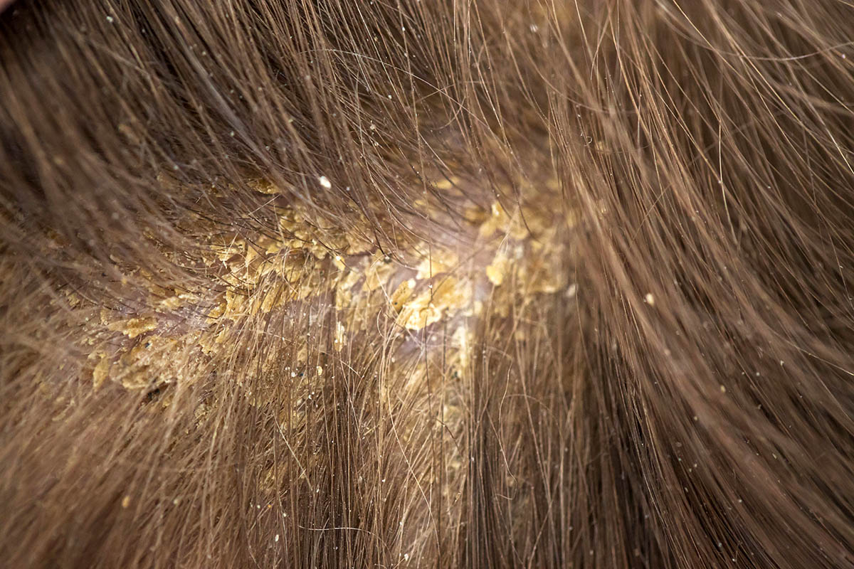 Oily Yellow Product Buildup