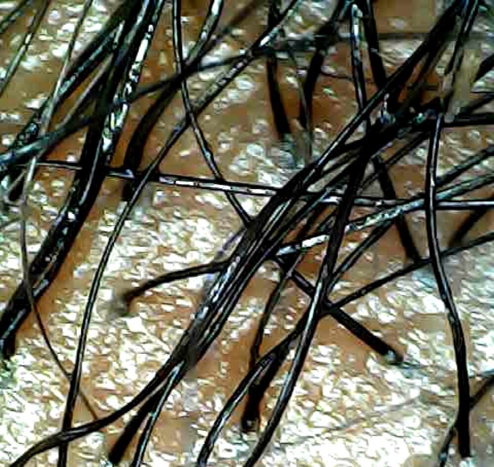 Oily Scalp